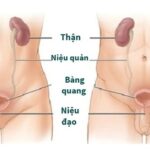 Nhận diện triệu chứng viêm đường tiết niệu ở nam và nữ chính xác