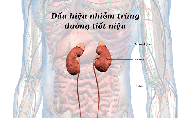 Những điều bạn cần biết về dấu hiệu nhiễm trùng đường tiết niệu