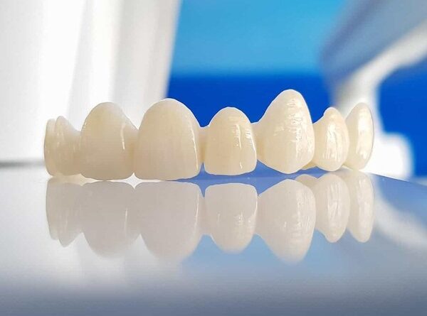 Mài răng bọc sứ có ảnh hưởng gì không? Lưu ý cần biết