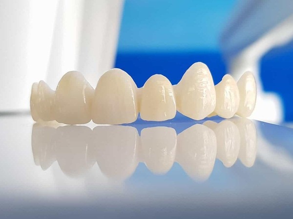 Mài răng bọc sứ có ảnh hưởng gì không? Lưu ý cần biết