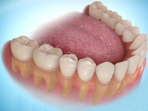 Những trường hợp cần thực hiện mài răng bọc sứ