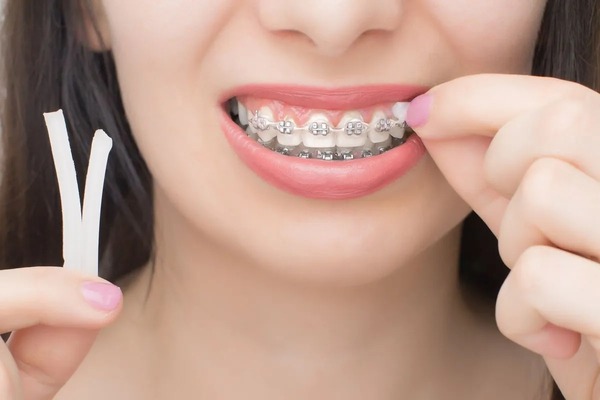 Nuốt sáp nha khoa có sao không? Lưu ý cần biết