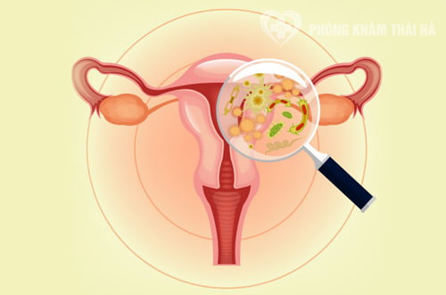 Biện pháp phòng tránh viêm đường tiết niệu nữ