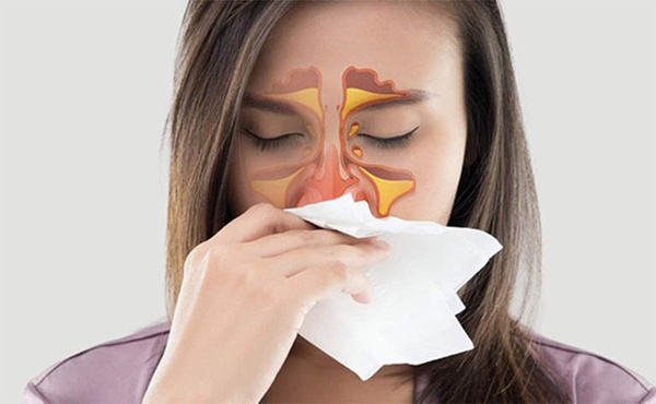 Phòng ngừa viêm xoang mũi