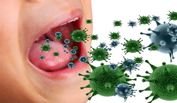 Viêm xoang giai đoạn nhiễm trùng