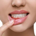 Lợi ích của việc lựa chọn các loại răng sứ phù hợp