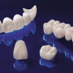 Bọc răng sứ Katana và những điểm cần biết