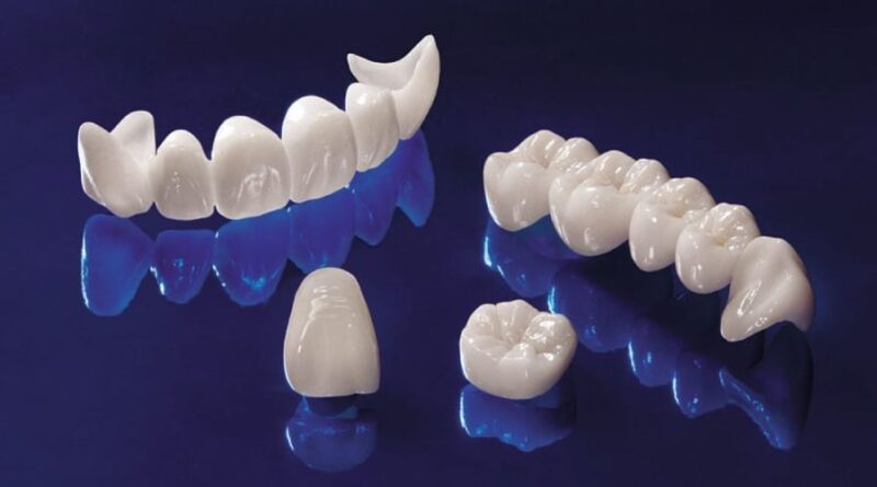 Bọc răng sứ Katana và những điểm cần biết