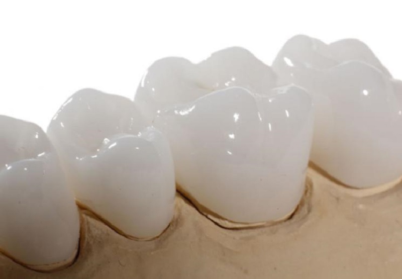 Bọc răng sứ Katana Nhật Bản chất lượng cao