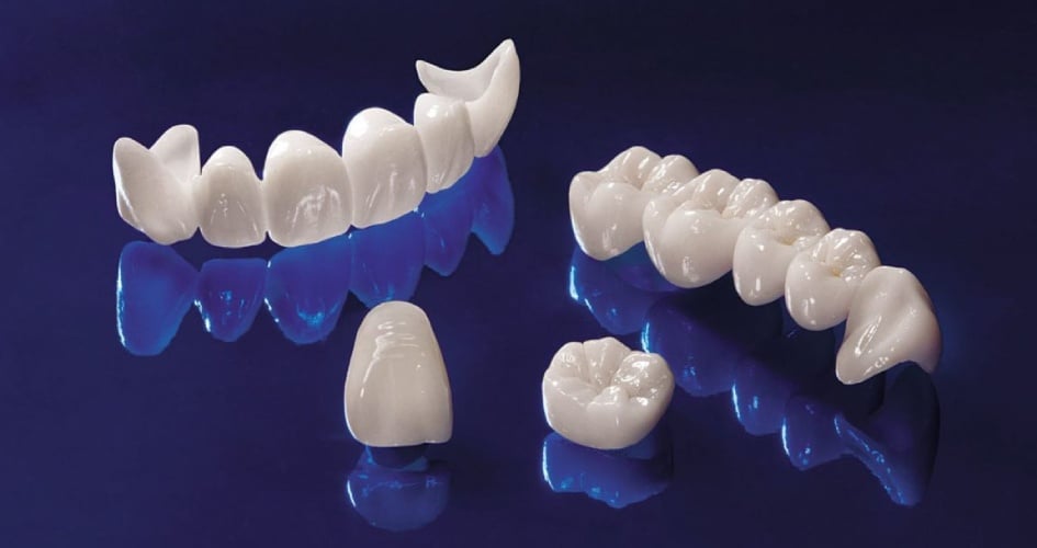 Bọc răng sứ Katana và những điểm cần biết