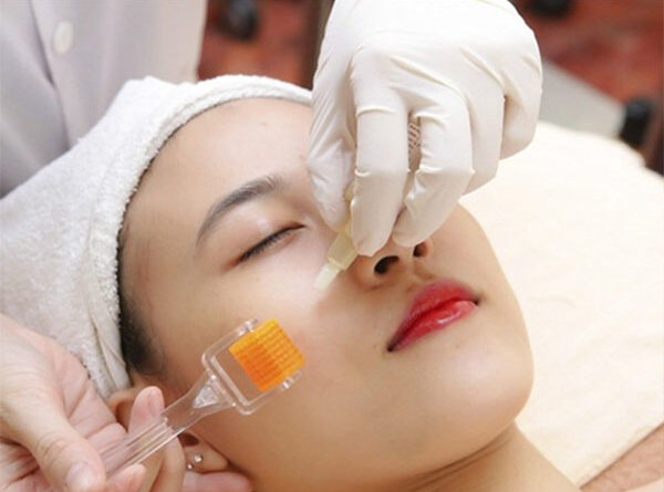 Lăn kim trị sẹo bao lâu thì thấy cải thiện rõ rệt