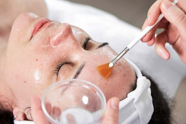 Peel da cho mụn ẩn có phù hợp theo tình trạng da